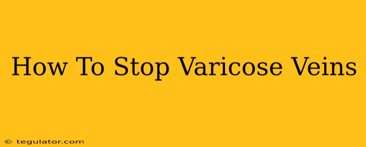 How To Stop Varicose Veins